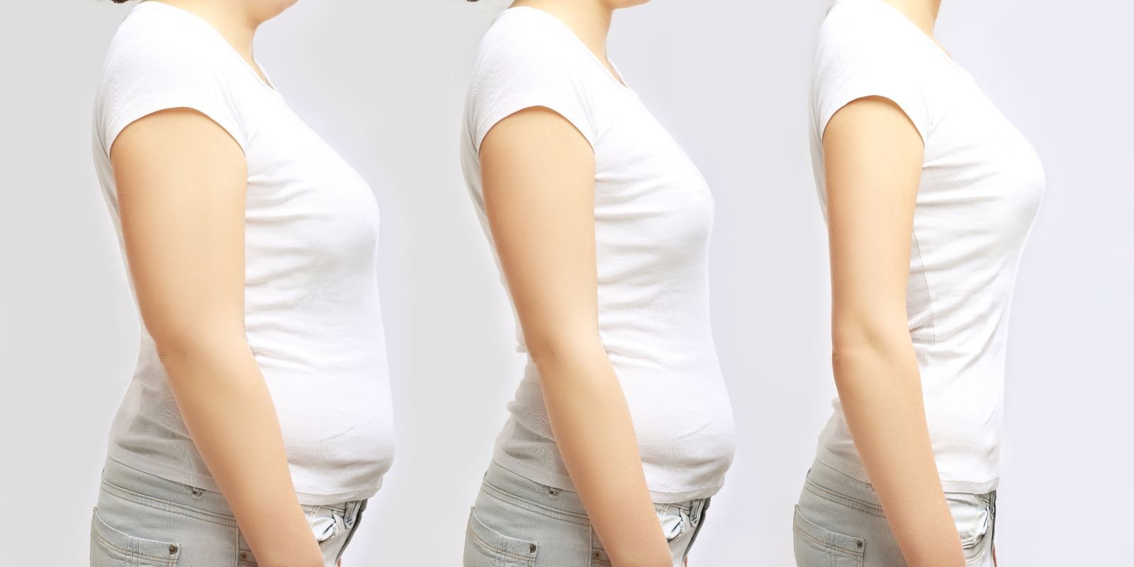 TOP 5 SOLUTIONS FOR SUSTAINABLE WEIGHT LOSS
